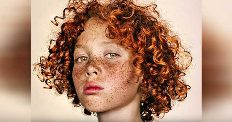 Fotograf med viktig budskap til dem som har rødt hår og fregner – Hylles verden over
